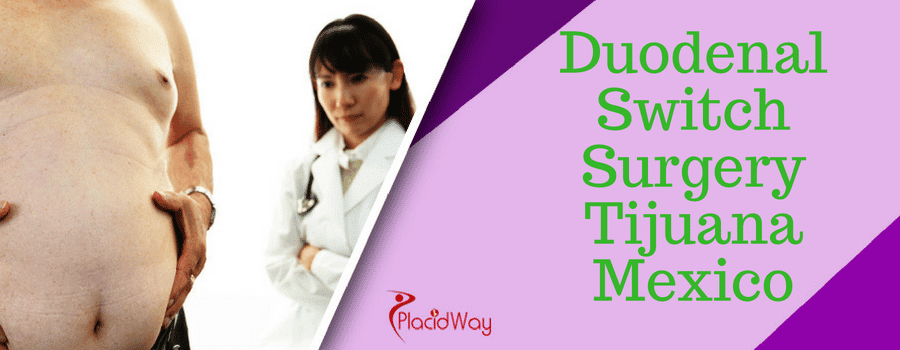 Duodenal Switch Surgery Tijuana Mexico